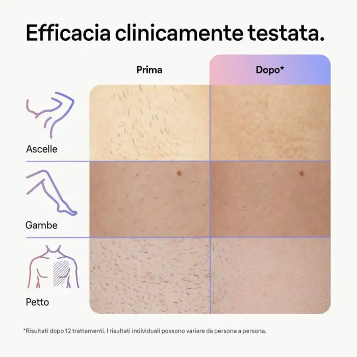 Braun Epilatore Luce Pulsata Smart Skin I·Expert, Epilazione A Casa Tua, Custodia, Rasoio Donna Venus, 2 Testine, PL7147 , 154729 , Immagine 6