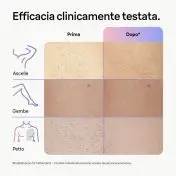 Braun Epilatore Luce Pulsata Smart Skin I·Expert, Epilazione A Casa Tua, Custodia, Rasoio Donna Venus, 2 Testine, PL7147